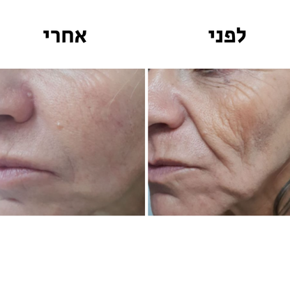 GlowMe-SkinWavePro™-מכשיר מתיחת פנים